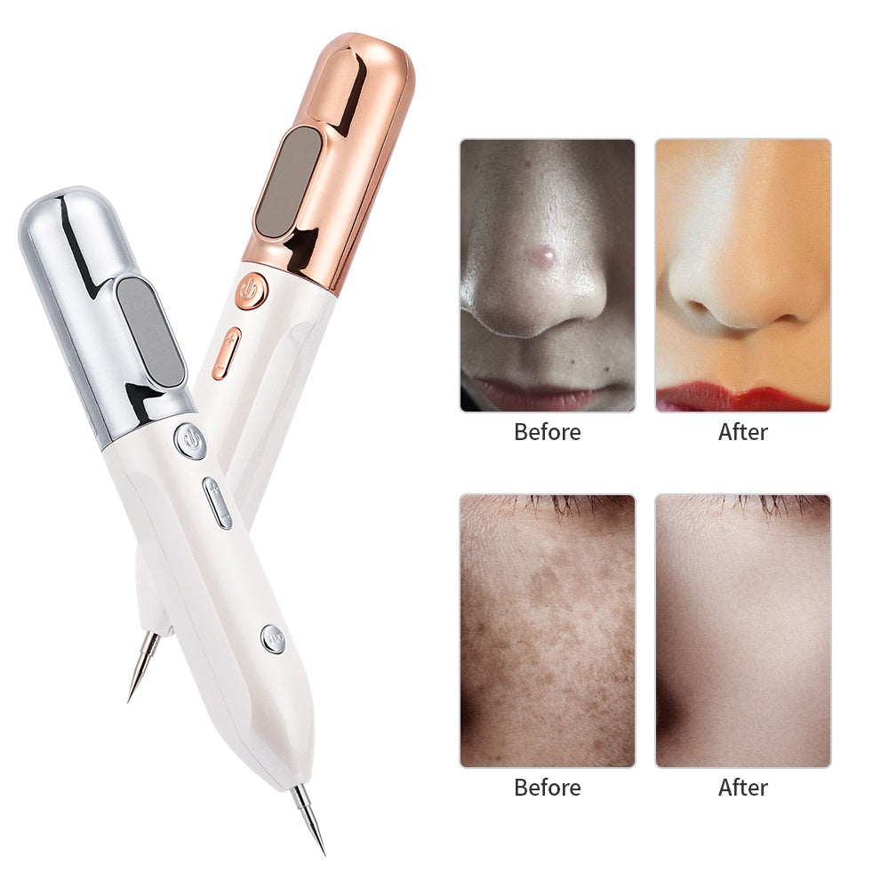 Nolan | Professional Plasma Pen – Remove Warts & Skin Tags UK